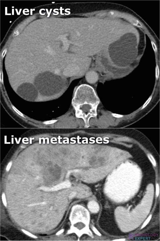 CT abdomen general